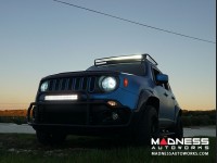 Jeep Renegade Fender Flares by MADNESS - Carbon Fiber